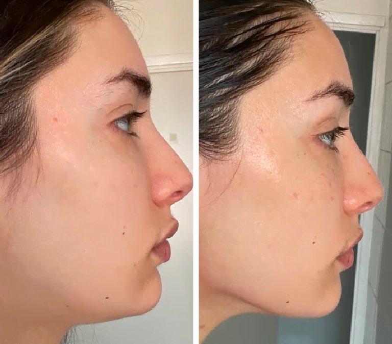 your face is layered. skin. fascia. muscle. fluid. gua sha moves all of it.

fascia is the connective tissue that holds everything together. when it’s tight, stuck, or dehydrated, it creates tension patterns. pulls muscles out of alignment. traps fluid. locks in asymmetries. this