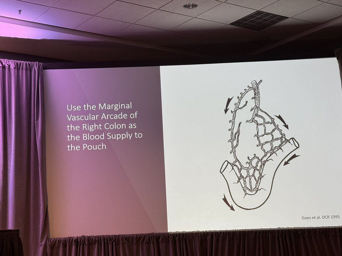Steven D Wexner MD, PhD (@swexner) on Twitter photo Outstanding presentation on laparoscopic pouch creation by <a href="/CleveClinicFL/">Cleveland Clinic Florida</a> <a href="/BoutrosMarylise/">Marylise Boutros</a> <a href="/SAGES_Updates/">SAGES is in Tampa in 2026!</a> #SAGES2025 <a href="/CAGS_ACCG/">Cdn General Surgeons</a> <a href="/mcgillsurgery/">McGill Surgery</a> Outstanding presentation on laparoscopic pouch creation by <a href="/CleveClinicFL/">Cleveland Clinic Florida</a> <a href="/BoutrosMarylise/">Marylise Boutros</a> <a href="/SAGES_Updates/">SAGES is in Tampa in 2026!</a> #SAGES2025 <a href="/CAGS_ACCG/">Cdn General Surgeons</a> <a href="/mcgillsurgery/">McGill Surgery</a>