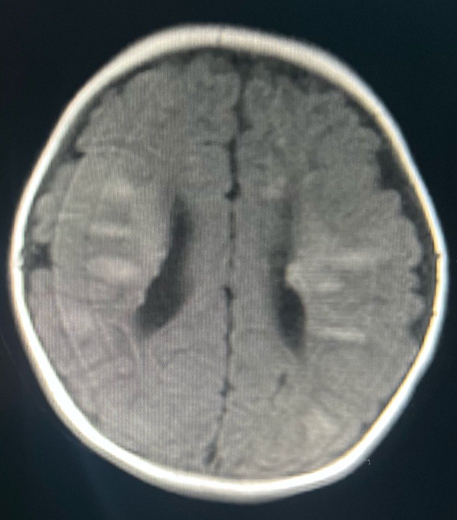 SPIN | Society of Pediatric Neuroimaging tweet media