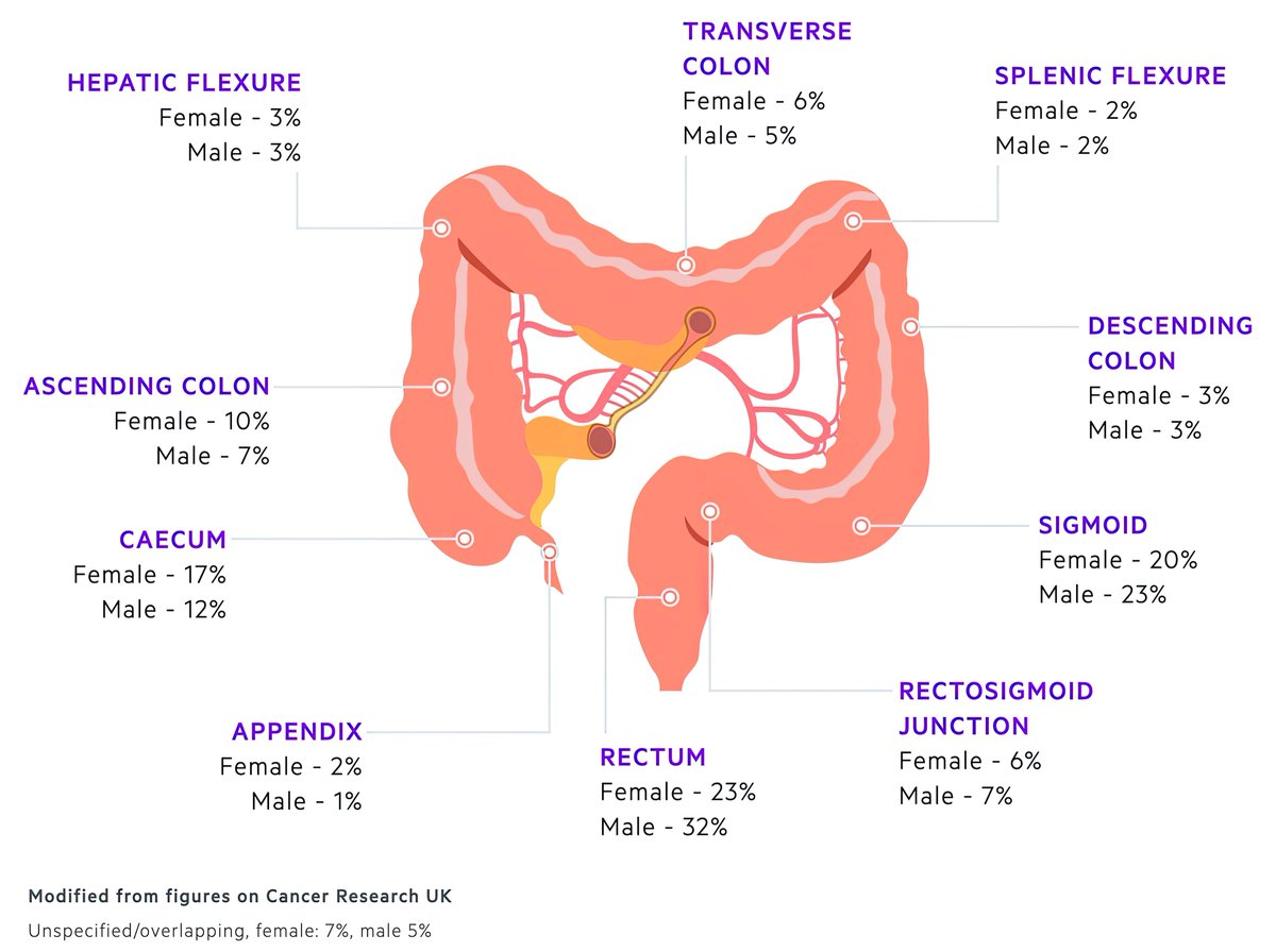 Dónde se diagnostica el cáncer colorrectal 📍
#ColorectalCancerAwarenessMonth #CCR
