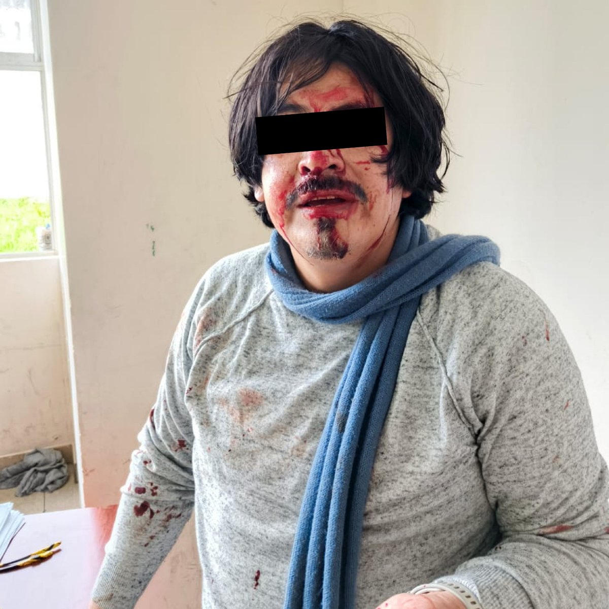 UNENACIONAL's tweet photo. 🛑 #URGENTE| COMUNICADO| FRENTE A LA BRUTAL AGRESIÓN A UN DOCENTE 

Desde la Unión Nacional de Educadores, expresamos nuestro profundo rechazo y preocupación ante la brutal agresión a un maestro de la Unidad Educativa Telmo Hidalgo Díaz, en el cantón Rumiñahui, provincia de Pichincha. Un "padre de familia" este jueves 13 de marzo con una actitud violenta e irracional, golpeó al docente con un objeto metálico, causándole fracturas en el rostro y obligando a su traslado inmediato a un centro de salud.

Nos solidarizamos con nuestro compañero, su familia y toda la comunidad educativa afectada. Este lamentable suceso no es un hecho aislado. Cada vez es más frecuente que los maestros (as) se enfrenten a agresiones físicas, extorsiones, amenazas y violencia dentro de los espacios educativos.

Denunciamos que en reiteradas ocasiones hemos alertado sobre esta realidad al Ministerio de Educación y el Gobierno, sin obtener respuestas claras ni soluciones efectivas.

Como docentes, no vamos  a permitir que la violencia se normalice en nuestras aulas. Las unidades educativas, universidades, institutos deben ser espacio seguros para todos: estudiantes, maestros, psicólogos educativos, pedagogos, personal de apoyo, administrativos, madres y padres de familia.

Dónde hay violencia el proceso de enseñanza y aprendizaje no avanza, no hay educación de calidad y es por eso que exigimos:

✔️ Acciones inmediatas contra los responsables de estos hechos.
✔️ Condiciones seguras para ejercer nuestra labor educativa.
✔️ Declaratoria de emergencia educativa ante la crisis que enfrentamos.
✔️ Respeto y revalorización del magisterio, para que la profesión docente no siga siendo vulnerada.

Desde la UNE, brindaremos acompañamiento legal y psicológico al docente afectado, pero no nos quedaremos en la denuncia. En los próximos días, nos movilizaremos porque estamos cansados de la inseguridad, del abandono estatal y del irrespeto a nuestra labor.

Convocamos a todo el magisterio y a la comunidad educativa a unirnos y organizarnos para exigir el derecho a enseñar y aprender en espacios educativos seguros.

Andrés Quishpe 
Presidente Nacional UNE

Klever Hidalgo
Presidente UNE - Pichincha
