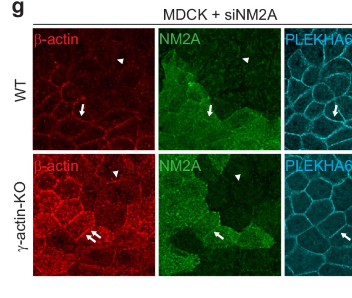 3. But, in addition, Marine noted that nonmuscle myosin2A was also increased and (!!!) by depleting NM2A the increase in beta was reversed!!! A mechanosensing feedback circuitry!!!