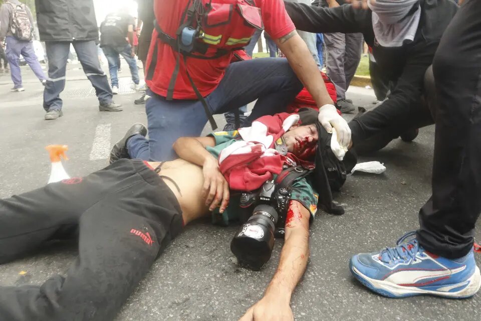 BrunoRguezP's tweet photo. En nombre de una "libertad" cada vez menos creíble, gobierno argentino reprime violentamente protestas organizadas por los más afectados por las políticas neoliberales aplicadas en #Argentina.

Convenientemente olvidan temas tan acuciantes como #DDHH y libertades fundamentales. https://t.co/LbiFSpRYNo
