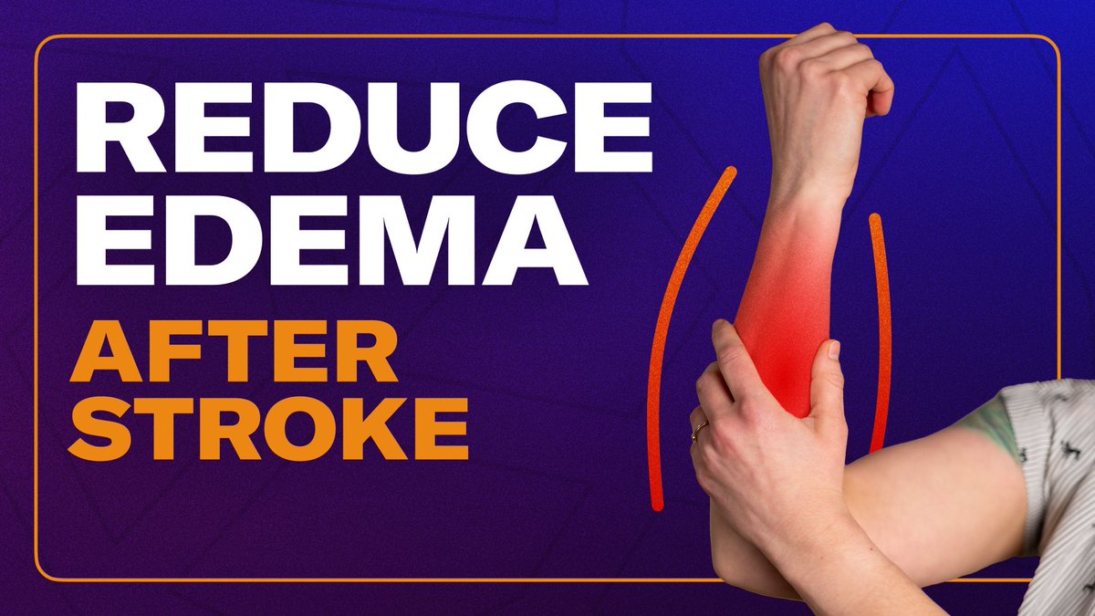 Is your affected arm or hand #swollen after your #stroke? In this video, I cover why swelling happens after stroke, effective treatments, and I demonstrate 10 evidence-based #exercises to reduce arm and hand swelling that you can do at home!

youtu.be/w4gORnGKvEU
