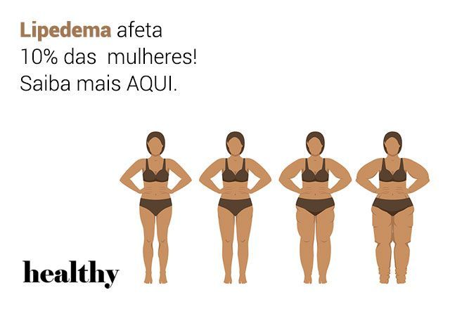 Você sabe o que é lipedema? 🤔 

Confundido com obesidade ou excesso de gordura comum, o lipedema tem sido frequentemente debatido. É um problema que afeta muito mais as mulheres, quase exclusivamente, e você ouve tudo sobre ele neste episódio de Healthy. buff.ly/vIEm0ig