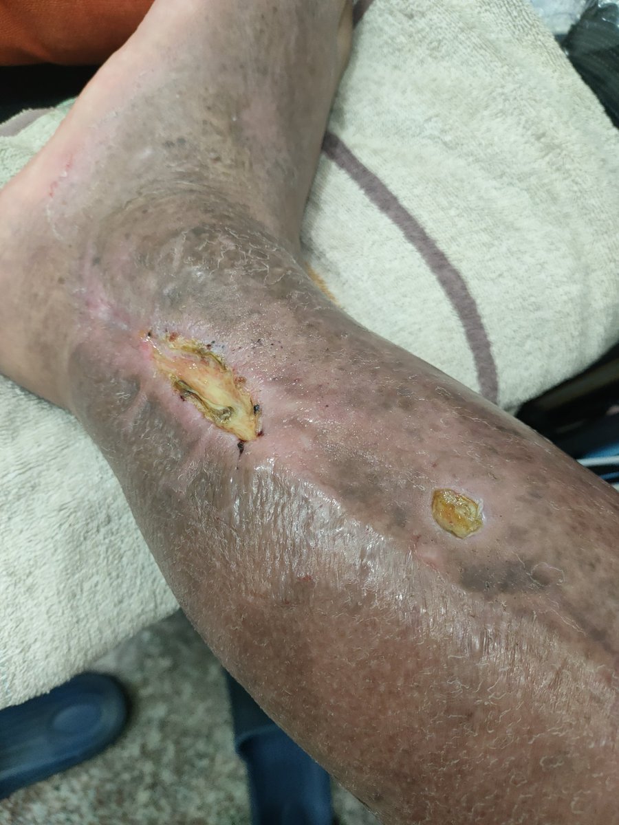 Accidie Chen (@accidiechen) on Twitter photo 