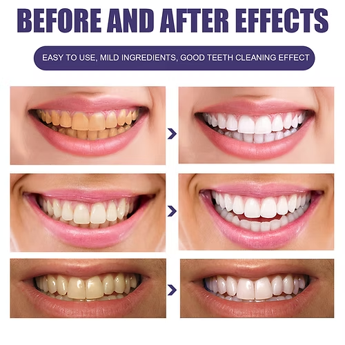 besthealthwell's tweet image. Tired of coffee stains and yellow tartar stealing your smile’s spotlight? ☕️🚫 Say hello to the 99g Purple Toothpaste!

Get it now at:
bestofthebesthealthwellness.com/product-page/9…

#OralWellness #PerfectSmile #BestToothpaste #TeethWhitening #OralCare #bestofthebesthealthwellness