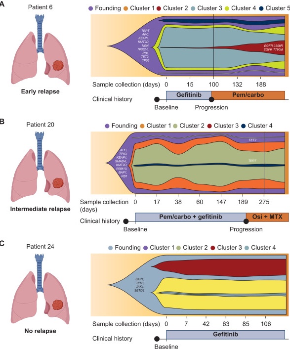 Amit Dutt (@amtdutt) on Twitter photo Why do some lung cancer patients relapse early on targeted therapy? Our study with Drs. K Prabhash, <a href="/VanitaNoronha/">Vanita Noronha, MBBS MD DM</a> & team from <a href="/TataMemorial/">Tata Memorial Hospital</a> in collab with Drs. J Khandare, G Shafi, & team from <a href="/onecelldx/">OneCell Diagnostics</a> published in ESMO Open (<a href="/ESMO_Open/">ESMO Open</a>) sheds insights. sciencedirect.com/science/articl… Why do some lung cancer patients relapse early on targeted therapy? Our study with Drs. K Prabhash, <a href="/VanitaNoronha/">Vanita Noronha, MBBS MD DM</a> & team from <a href="/TataMemorial/">Tata Memorial Hospital</a> in collab with Drs. J Khandare, G Shafi, & team from <a href="/onecelldx/">OneCell Diagnostics</a> published in ESMO Open (<a href="/ESMO_Open/">ESMO Open</a>) sheds insights. sciencedirect.com/science/articl…