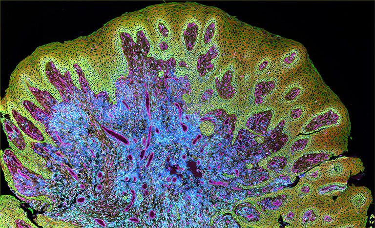 Congratulations to Stephanie Yiu, Ankit Basak, Ye Won Cho, Laura Kiessling, Chia-Yu Chen, Alex K. Shalek, David Kim &amp; Sizun Jiang for winning the KI Images People's Choice Award! Their image, "Periodontal Petals", shows how cells organize to maintain oral health.