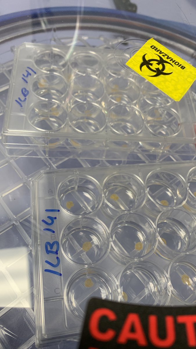 Paula Boeira, PhD (@paula__boeira) on Twitter photo First time using our βslicingβ room inside our new Environmental Hepatology lab.
Two plates of human precision-cut liver slices produced β
<a href="/HepatoPlymouth/">Hepatology Plymouth</a> <a href="/RDInUHP/">Plymouth Research and Development Team @UHP_NHS</a> <a href="/PlymUniResearch/">Plymouth Research</a> <a href="/ChokshiLab/">Chokshi Lab London</a> First time using our βslicingβ room inside our new Environmental Hepatology lab.
Two plates of human precision-cut liver slices produced β
<a href="/HepatoPlymouth/">Hepatology Plymouth</a> <a href="/RDInUHP/">Plymouth Research and Development Team @UHP_NHS</a> <a href="/PlymUniResearch/">Plymouth Research</a> <a href="/ChokshiLab/">Chokshi Lab London</a>