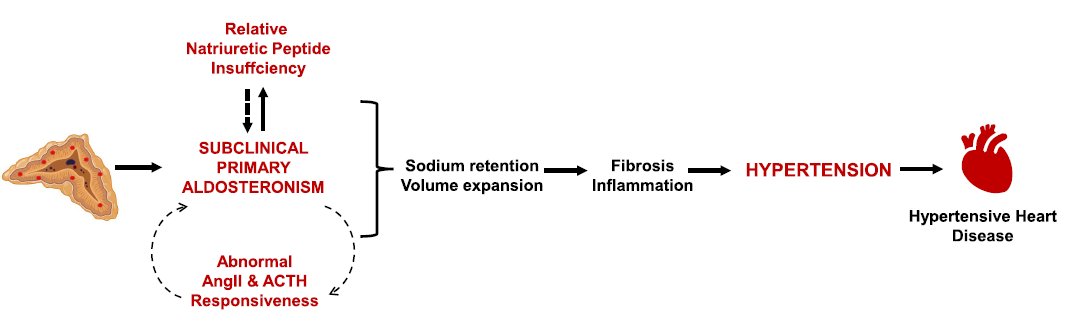 Anand Vaidya (@anandvaidya17) on Twitter photo Subclinical primary aldosteronism + Natriuretic Peptide Insufficiency => HYPERTENSION
academic.oup.com/jcem/advance-a… Subclinical primary aldosteronism + Natriuretic Peptide Insufficiency => HYPERTENSION
academic.oup.com/jcem/advance-a…