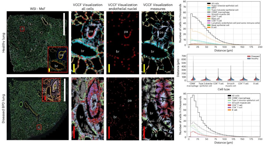 Nature Methods (@naturemethods) on Twitter photo Pleased to announce this Resource that describes data, code and tools developed for the Human Reference Atlas and the Human BioMolecular Atlas Program <a href="/_hubmap/">Human BioMolecular Atlas Program (HuBMAP)</a> for building and navigating a multiscale human atlas. nature.com/articles/s4159… Pleased to announce this Resource that describes data, code and tools developed for the Human Reference Atlas and the Human BioMolecular Atlas Program <a href="/_hubmap/">Human BioMolecular Atlas Program (HuBMAP)</a> for building and navigating a multiscale human atlas. nature.com/articles/s4159…