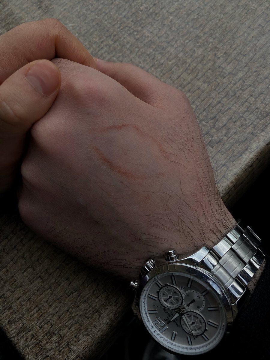 Küçük detaylar 💋