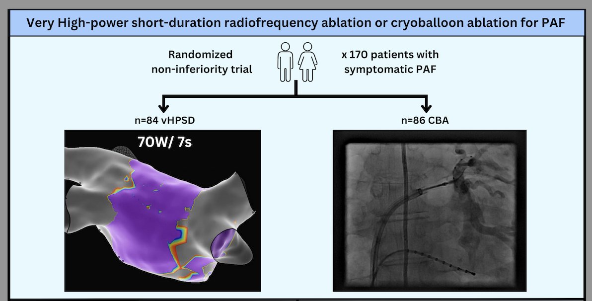 Jose Luis Merino (@joselmerino) on Twitter photo 🔥 vHPSD vs. cryoablation for paroxysmal AF: The HIPAF Trial will be presented as an LBCT at #EHRA2025! Congrats to Arian Sultan and colleagues on this important study. Looking forward to the results! #AFib #Electrophysiology #EP <a href="/EHRAPresident/">EHRAPresident</a> <a href="/simovicst/">Stefan Simović</a> 🔥 vHPSD vs. cryoablation for paroxysmal AF: The HIPAF Trial will be presented as an LBCT at #EHRA2025! Congrats to Arian Sultan and colleagues on this important study. Looking forward to the results! #AFib #Electrophysiology #EP <a href="/EHRAPresident/">EHRAPresident</a> <a href="/simovicst/">Stefan Simović</a>