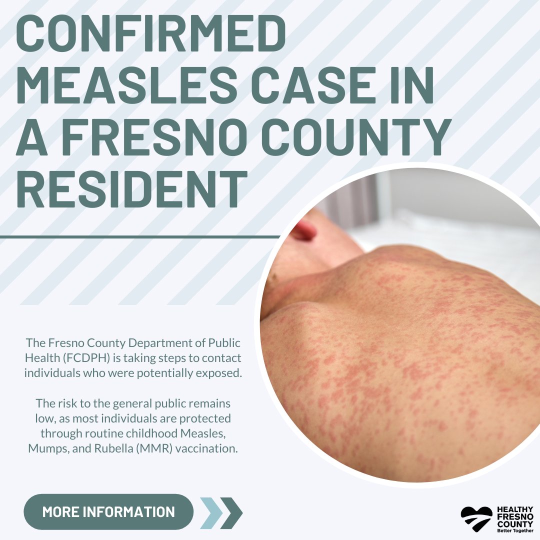 healthyfresnoco's tweet photo. Confirmed measles case in a Fresno County resident. Learn more: https://t.co/Sdhan3MIEF via @Nextdoor https://t.co/UbuqfR3HHi