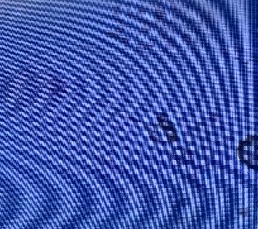 garyb7805's tweet image. Successfully retrieved testicular sperm (in good numbers) in a complex case for IVF today. Some sperm appeared European and even had berets in the pictures - one hatless and one stylishly sporting a beret. #IVF #SpermRetrieval  #Berets
