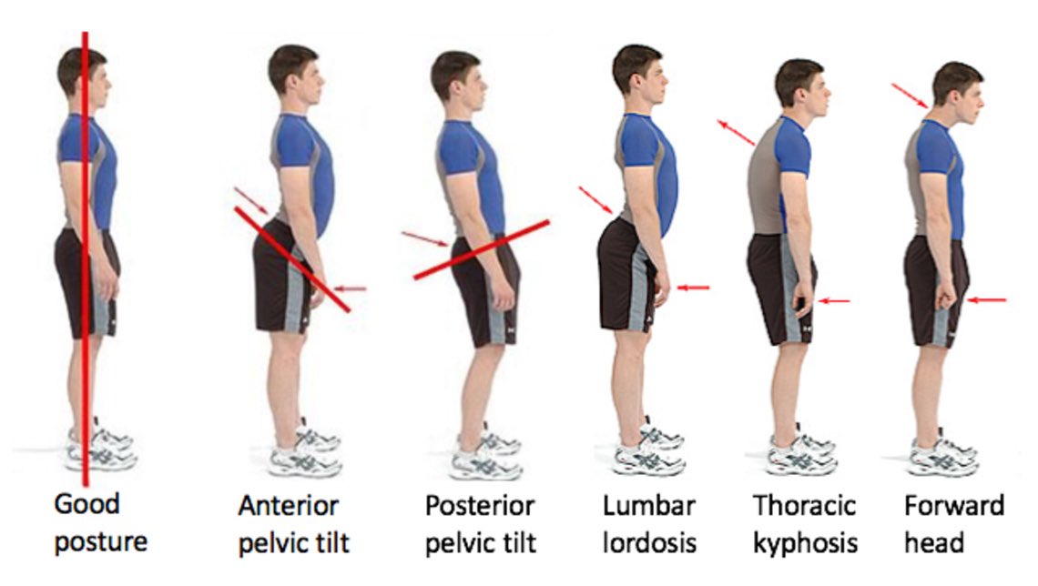 Roggenbucker's tweet photo. Y’all if I ever start having posture like one of these mf, please put a shotgun to my head https://t.co/ntEDpTJMzx