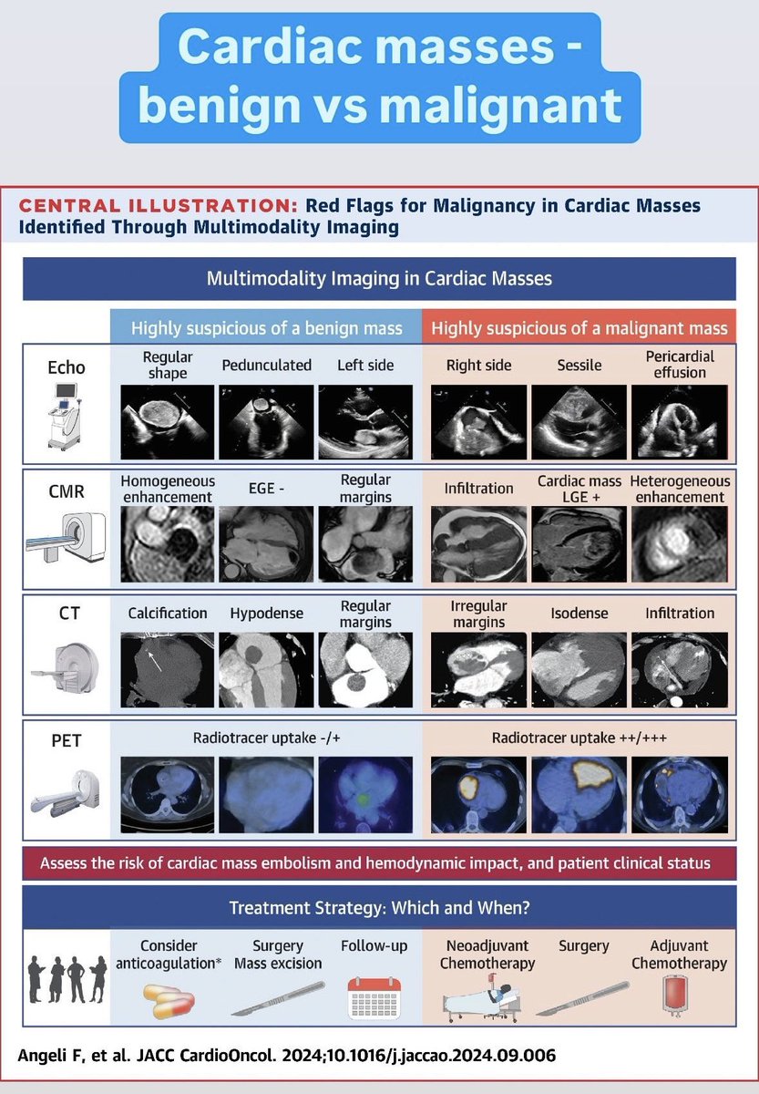 ~~ Cardiac Masses ~~

Benign vs malignant on multimodality imaging
#EchoFirst #yesCCTA #whycmr