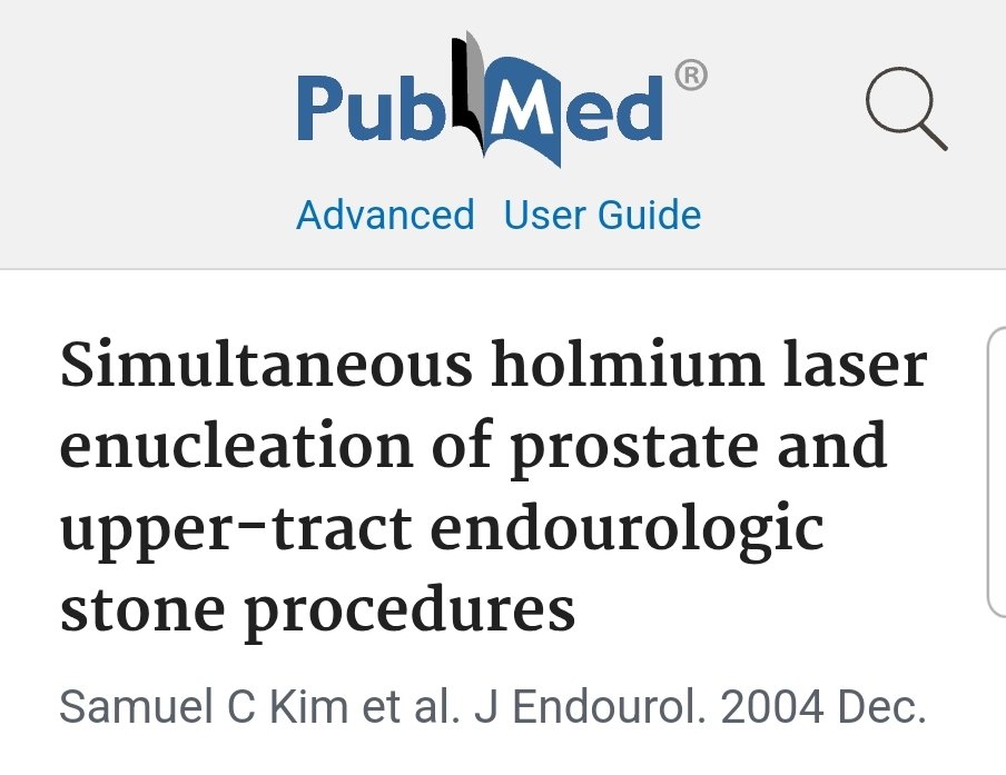 GSBenC's tweet photo. Totally En Bloc #HOLEP combined with #Ureteroscopy for stone disease.
Versatility of a High power #Holmiunlaser 100W #Quantasystem .Two problems, One OR visit, no impact on recovery
#urosome
#endourology
#AEEP https://t.co/4hEwndyTCT