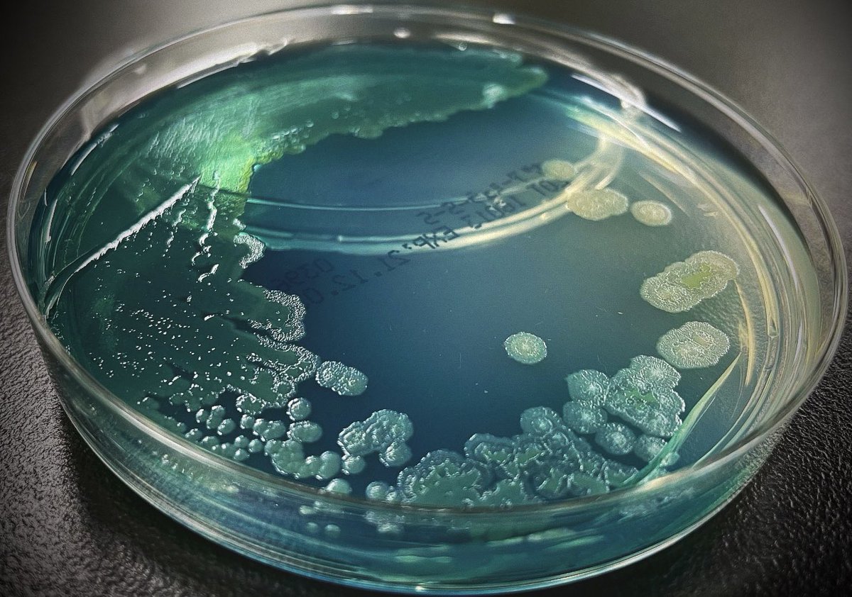DraWataru's tweet photo. Pseudomonas aeruginosa... https://t.co/CT8dlYAchC