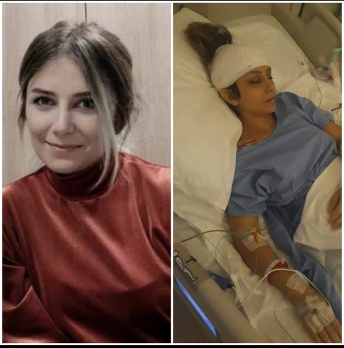 Özge Özbek 39 yaşında gencecik bir kadın
ve beyin tümörü var ve cezaevinde ısrarla
tutuluyor. Defalarca infaz erteleme raporları
için başvurdu ve hastaneler ona tahliye vermediler.Tüm hastalar için daha fazla gecikilmesin. İnfaz ertelemesi biran önce verilmelidir ..!!