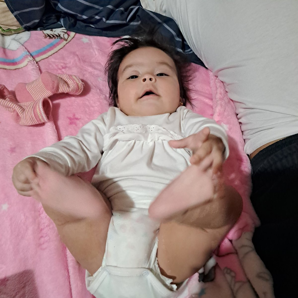 Disculpen pero una hermosa aprendió a tomarse las patitas 🐷❤️‍🩹