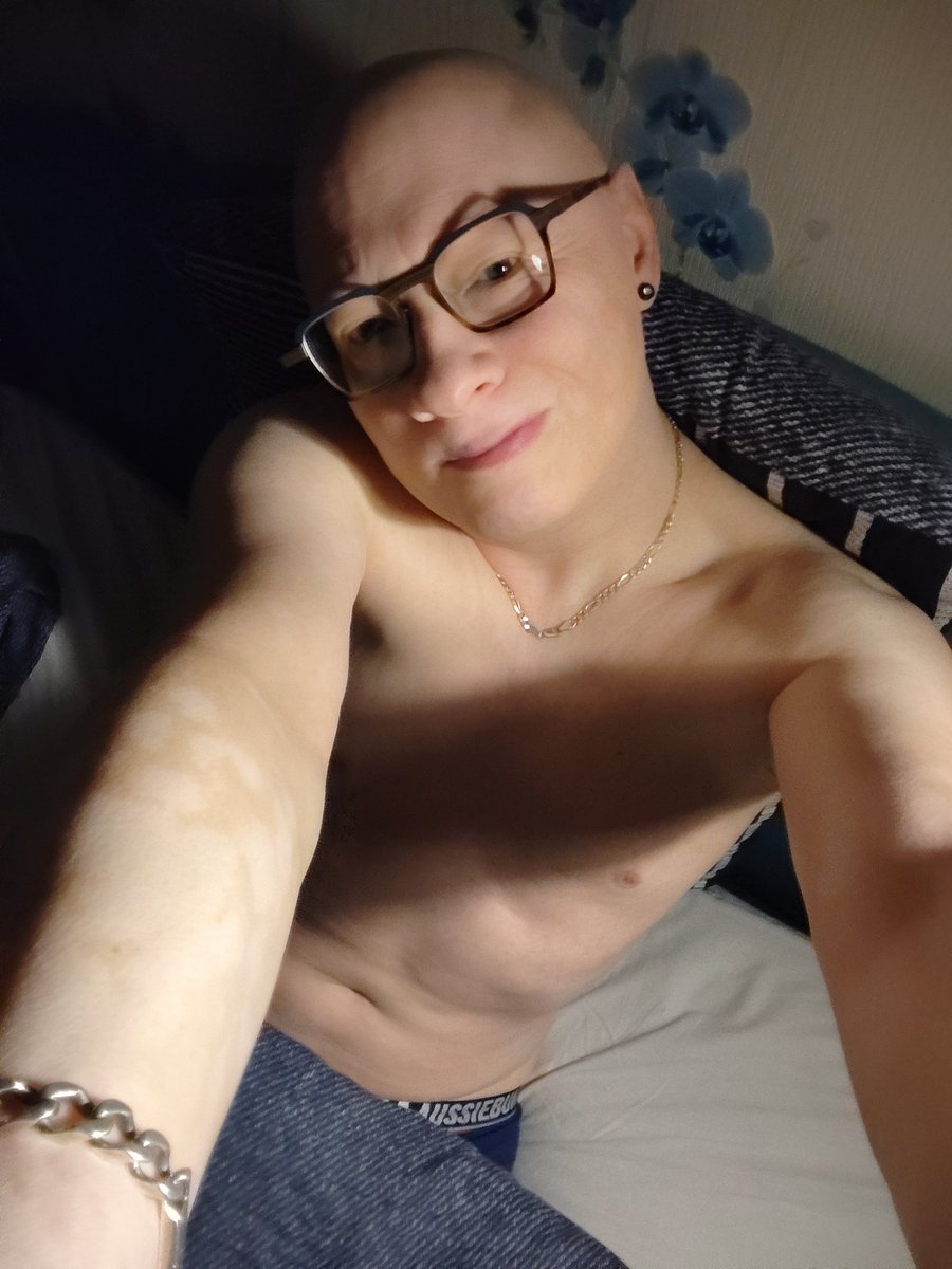 vildamour's tweet photo. #positivebody #alopecie c'est avec mon corps tout lisse et encore tout chaud de la chaleur de la couette que je vous souhaite un bon week-end les Xtis 🤗 je vous kiffe grave 😘 https://t.co/wxDWnU1Mbt