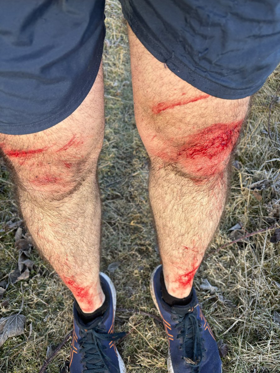 BoylePete1970 BIG OLD PETE tweet media