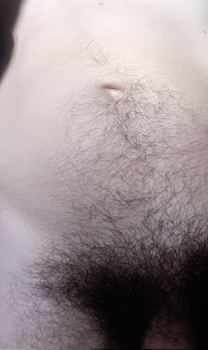 Hairy 😳
