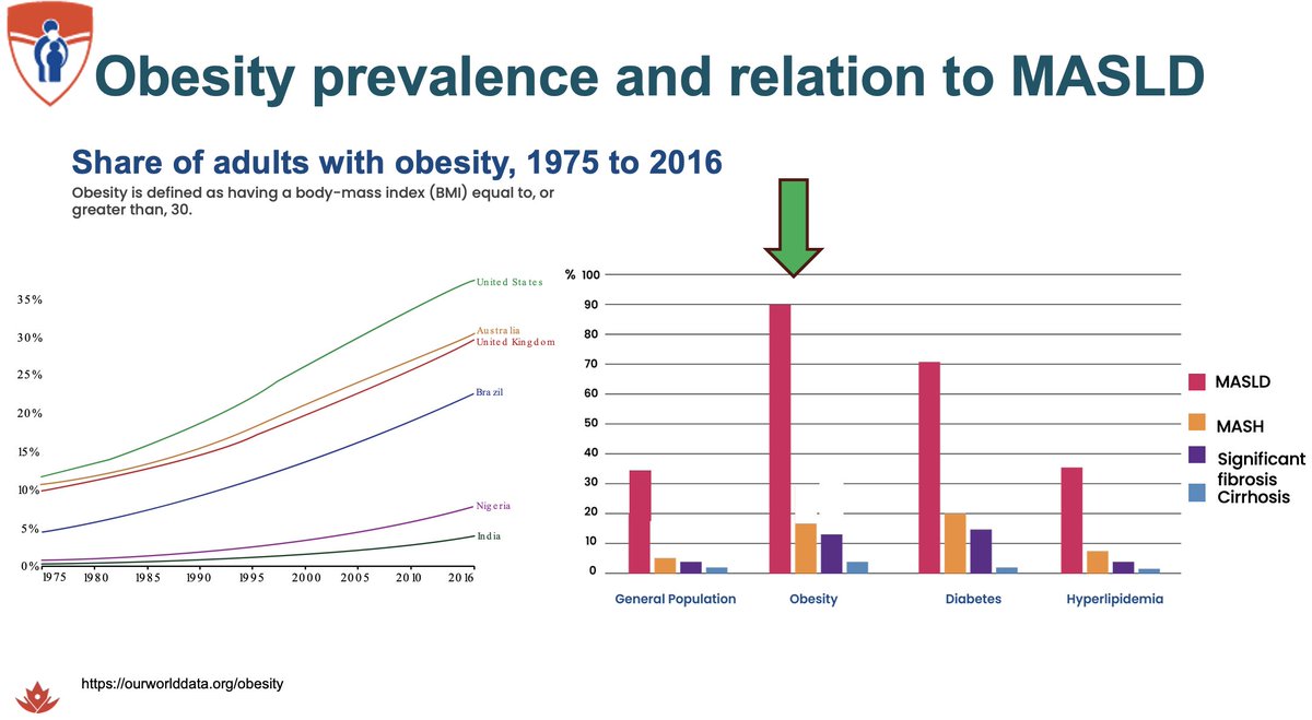 Giada Sebastiani (@giadasebastiani) on Twitter photo ✨Excited to participate in National Clinical #Obesity Update by <a href="/ObesityCan/">Obesity Canada</a>🚀
✳️ Around 80% of people living with obesity have #MASLD
✳️ Addressing obesity requires a multispecialistic & holistic approach—integrating medical, nutritional, and psychological care
#LiverHealth ✨Excited to participate in National Clinical #Obesity Update by <a href="/ObesityCan/">Obesity Canada</a>🚀
✳️ Around 80% of people living with obesity have #MASLD
✳️ Addressing obesity requires a multispecialistic & holistic approach—integrating medical, nutritional, and psychological care
#LiverHealth