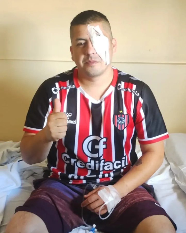 SonPolemicas's tweet photo. En Argentina le disparan en los ojos a los que protestan, en Chile le disparan en los ojos a los que protestan...Pero la "dictadura" es Venezuela ?

@CMonteroOficial https://t.co/026I0DaB2u