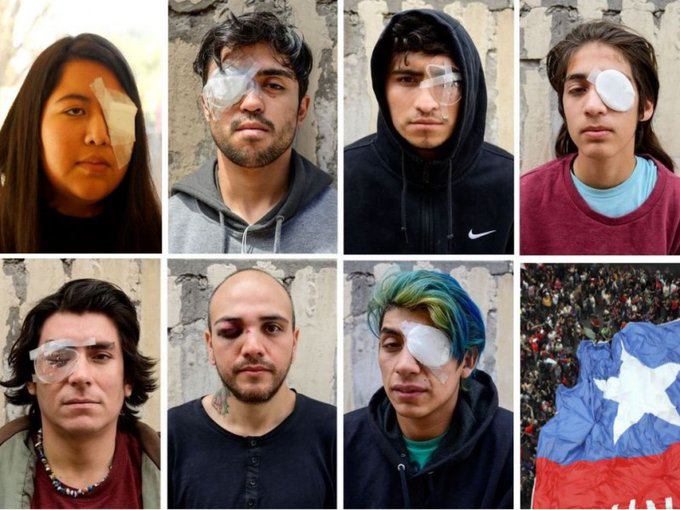 SonPolemicas's tweet photo. En Argentina le disparan en los ojos a los que protestan, en Chile le disparan en los ojos a los que protestan...Pero la "dictadura" es Venezuela ?

@CMonteroOficial https://t.co/026I0DaB2u
