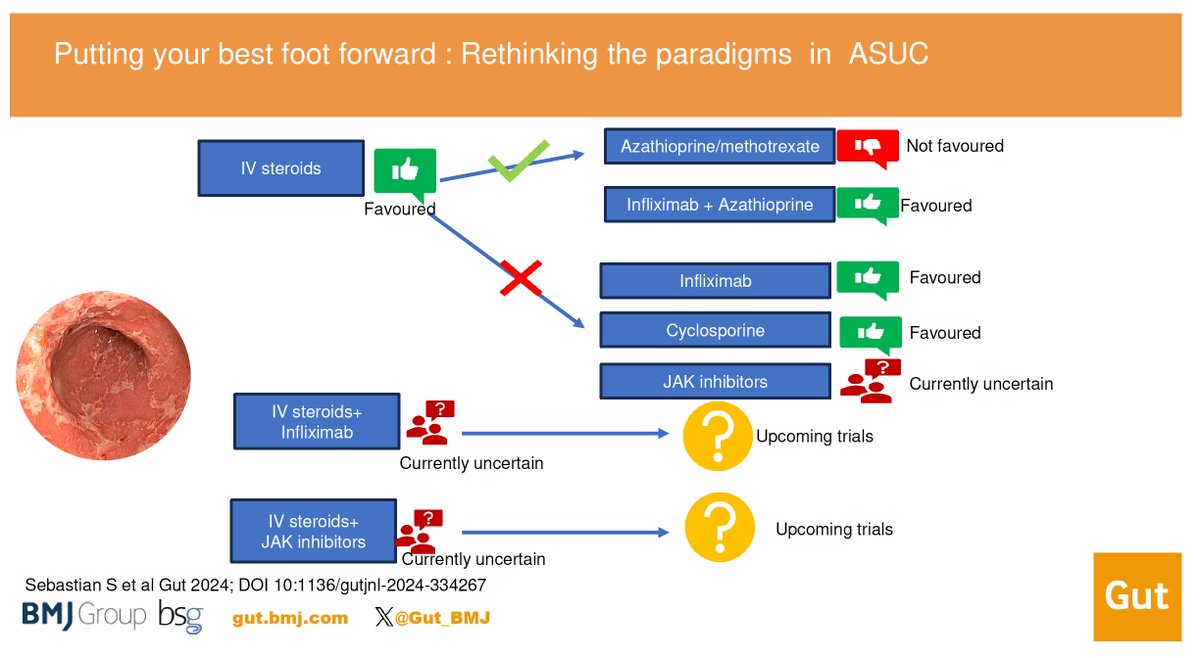 Gut Journal (@gut_bmj) on Twitter photo Read the #GUTCommentary by <a href="/ibdseb/">Seb</a> et al on 
"Putting the best foot forward: rethinking the paradigms in ASUC" via bit.ly/4bgfXeE
#IBD #ASUC Read the #GUTCommentary by <a href="/ibdseb/">Seb</a> et al on 
"Putting the best foot forward: rethinking the paradigms in ASUC" via bit.ly/4bgfXeE
#IBD #ASUC