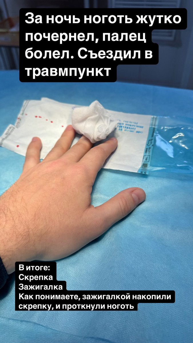 DVRud's tweet image. Неожиданно, мне проткнули палец раскаленной скрепкой. Отвратительный звук, брызги крови, бинт