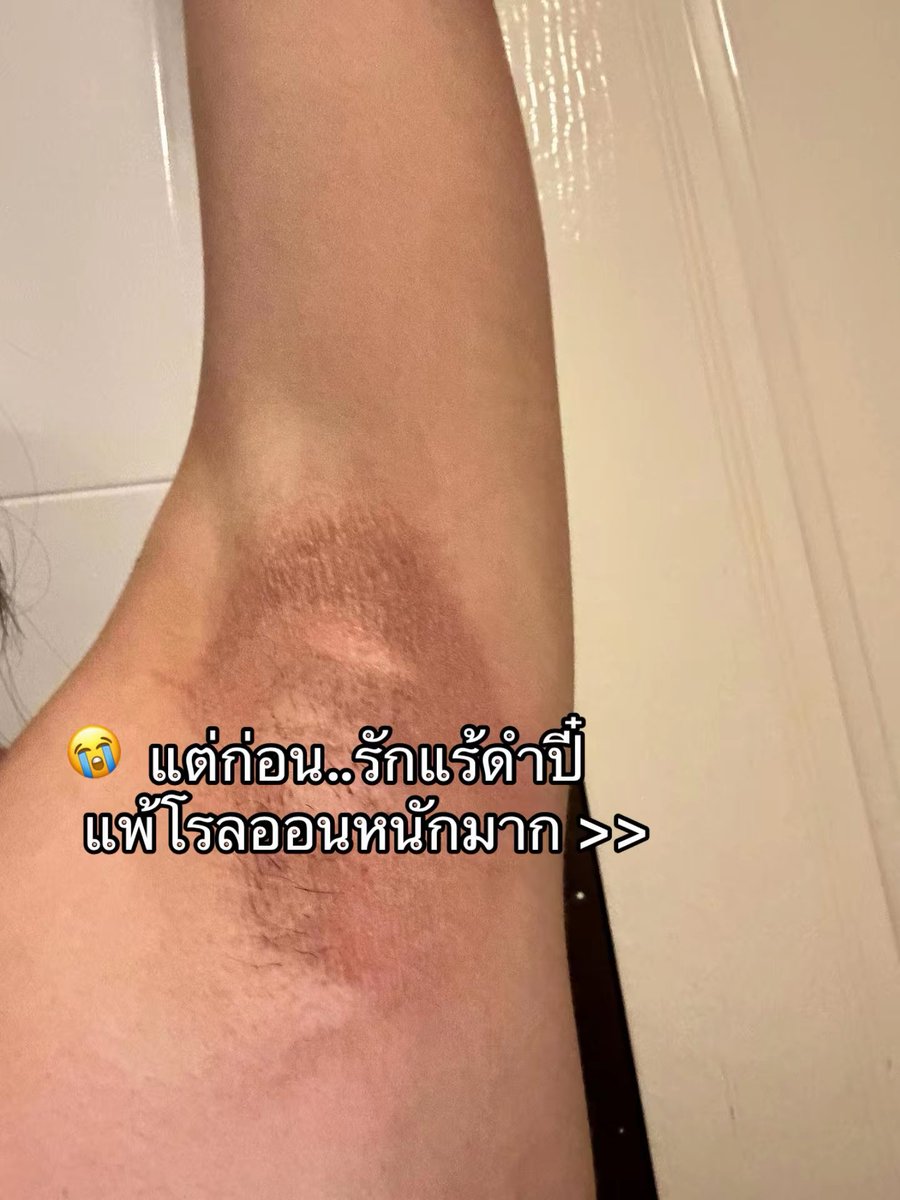 อันนยอง tweet media