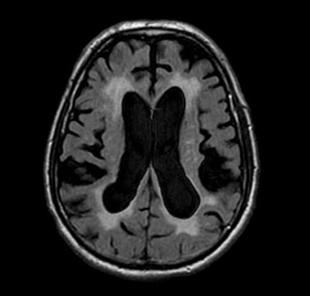 Neuromed tweet media