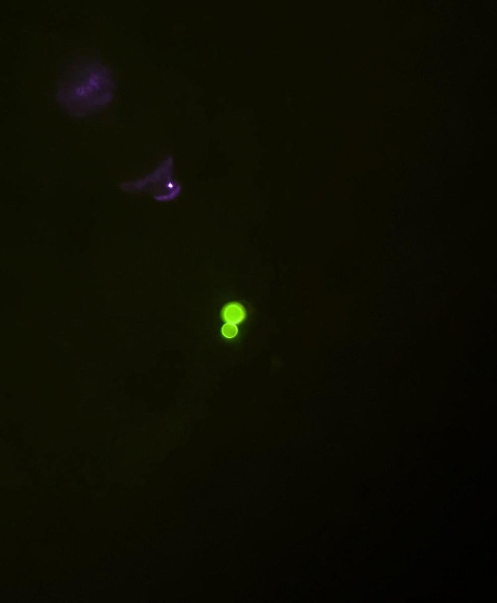 sebpoule's tweet photo. Calcofluor
14-15 um
#IDxposts #MicroRounds https://t.co/e2TlPnOvJc
