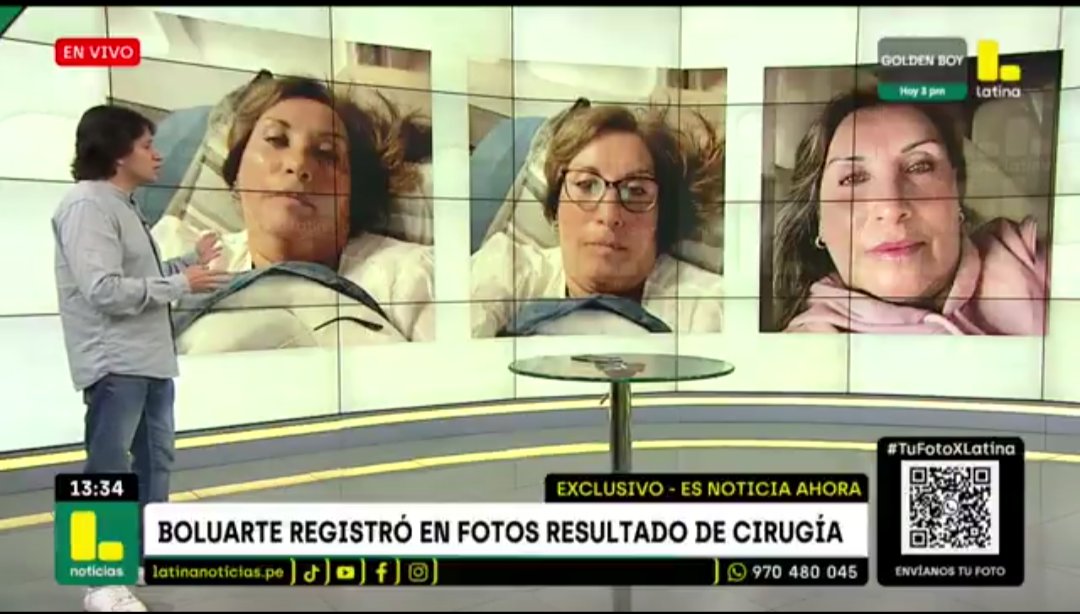 Dina Boluarte podrá estirarse la cara, redondearse los ojos, plancharse la frente o bajarse la papada.
Lo que nunca podrá hacer es arreglar su alma podrida.
50 muertos por su represión; muchos más por el sicariato que permite.
No es un gobierno de liftings, sino de autopsias.