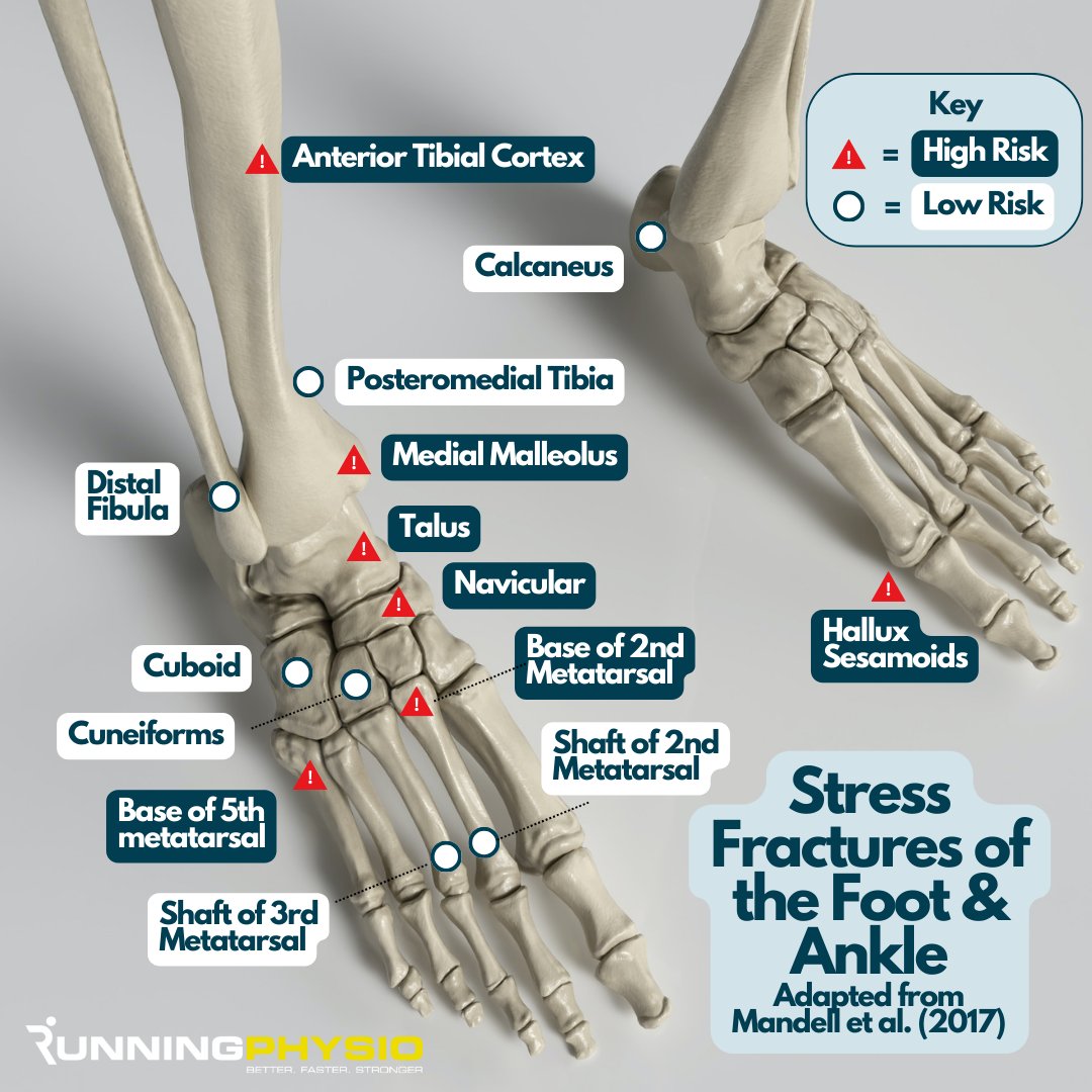 Stress fractures of the foot and ankle