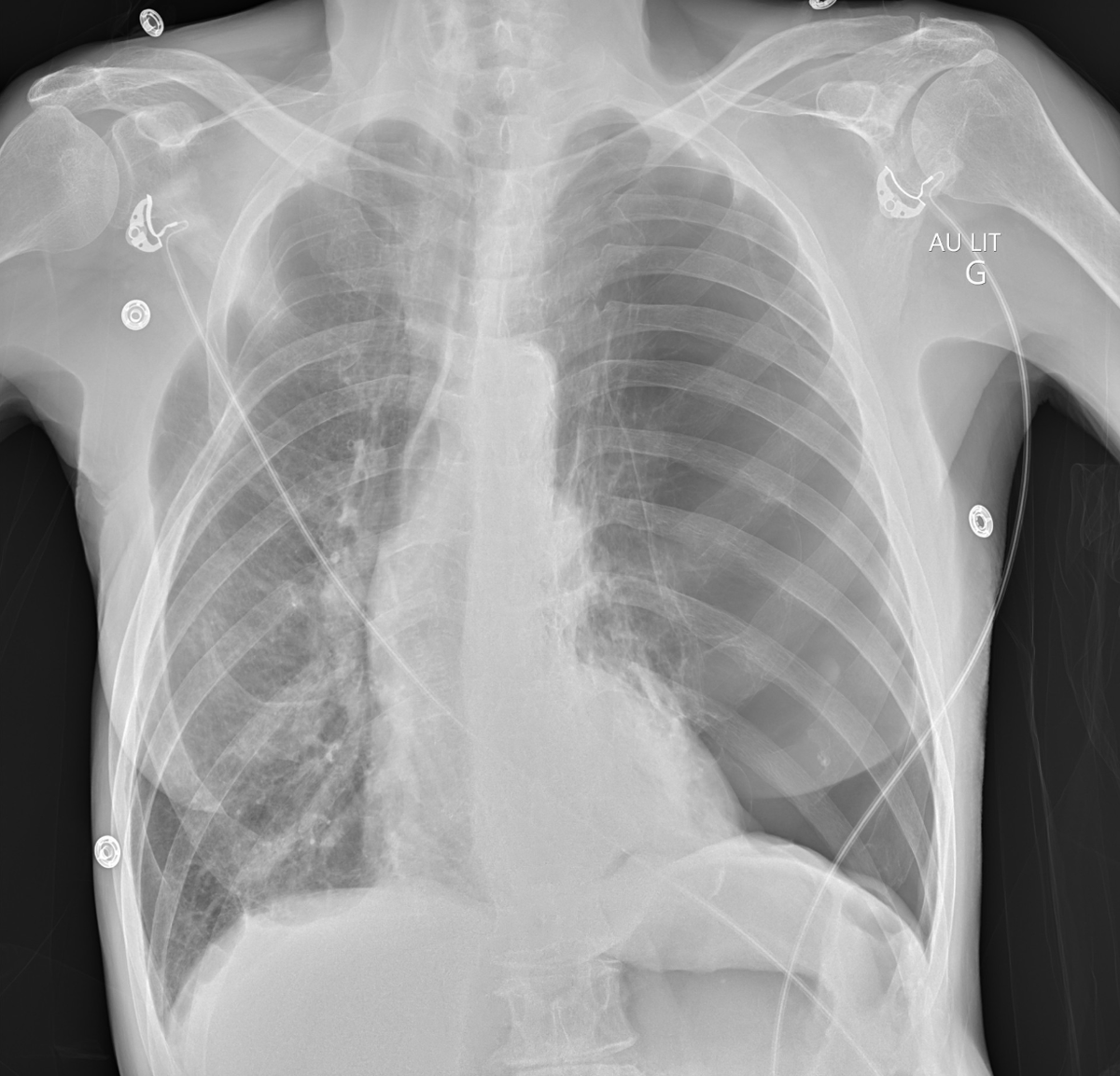 Rhazelovitch tweet media