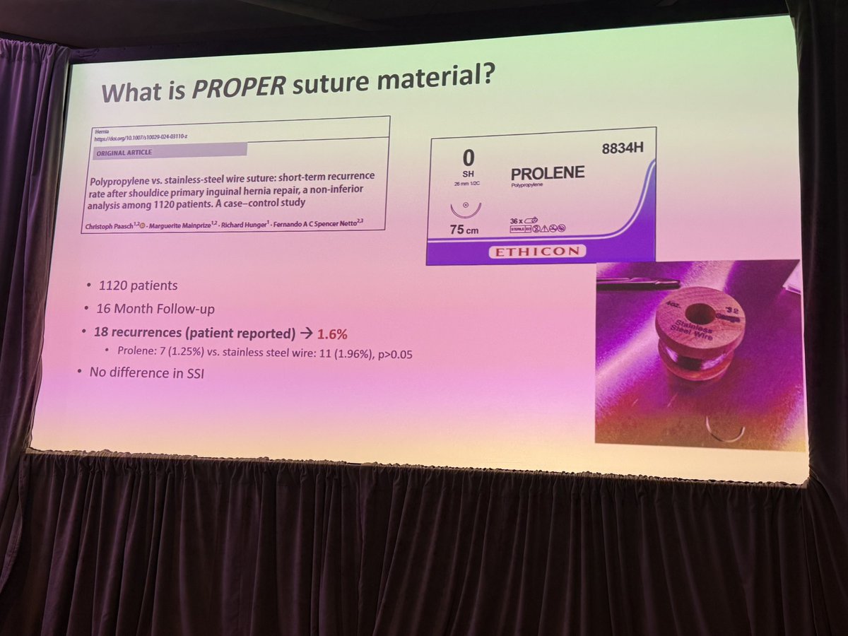Herniadoc's tweet photo. Next up: @DrMeganMS of Toronto, who also operates at the Shouldice Clinic, provided us an insightful step by step #Shouldice repair tutorial.
Interesting she shared her data re steel vs polypropylene and there was no change in recurrence.
I’m curious if there was a difference in chronic pain rate between the two sutures. 🤔
@SAGES_Updates #SAGES2025