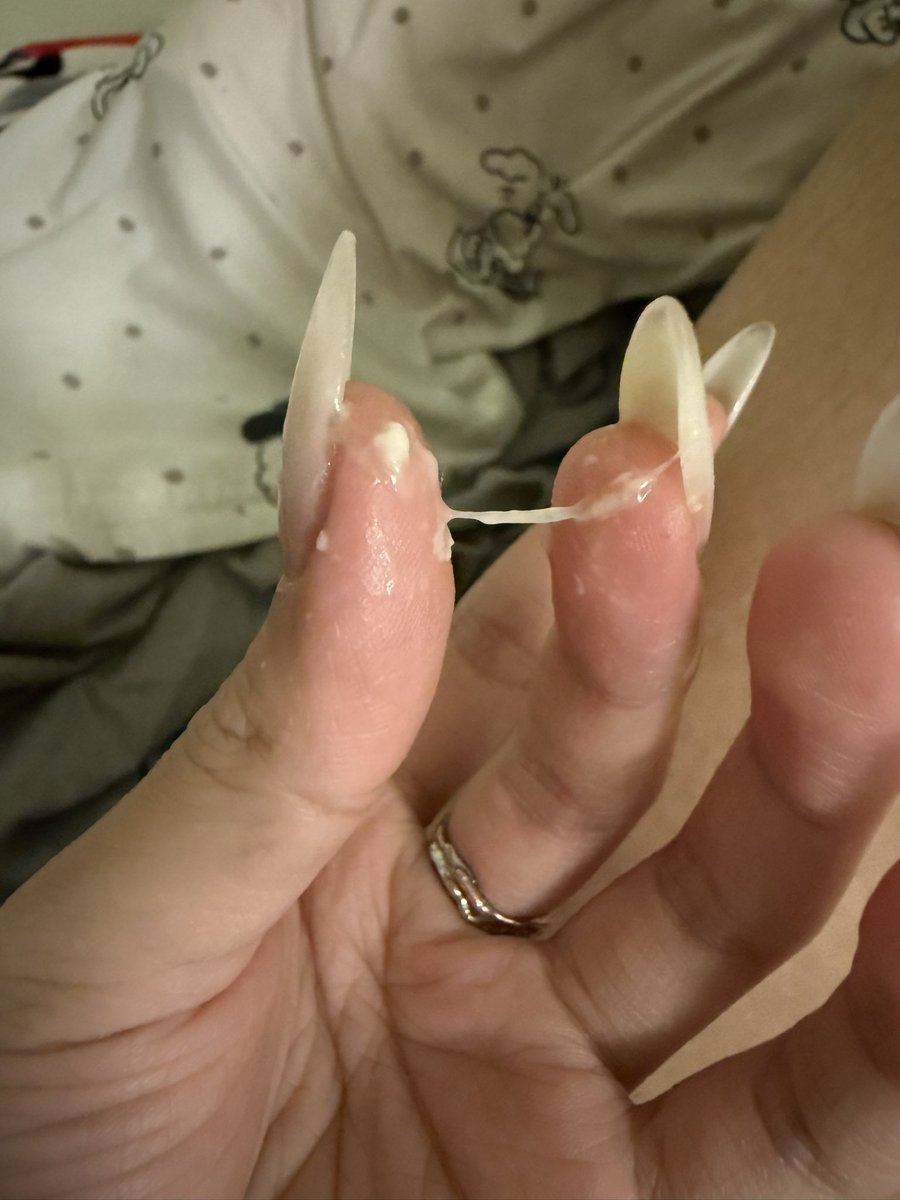 媒体预览