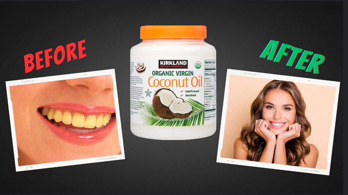 sterlingbray_'s tweet photo. Coconut Oil can give you white teeth?

Oil pulling is real and works great. I’ve been doing it on and off since I was around 10 years old and I often get comments about the whiteness of my teeth.

I’ve never used any unnatural teeth whitening products.

5-20 mins a day, swishing coconut oil in your mouth will help clean and whiten your teeth.

Check out my video below to hear more about it