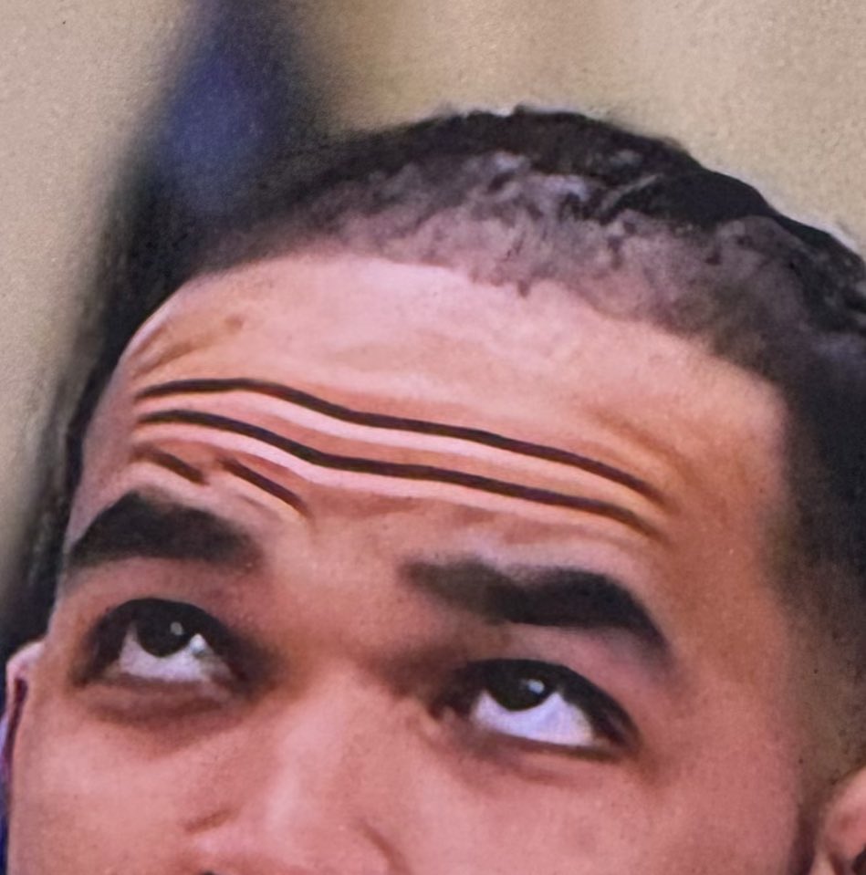 BatteredVawl516's tweet photo. Somebody needs to tighten up this paint job.  #Receding https://t.co/K0nEgQckQk