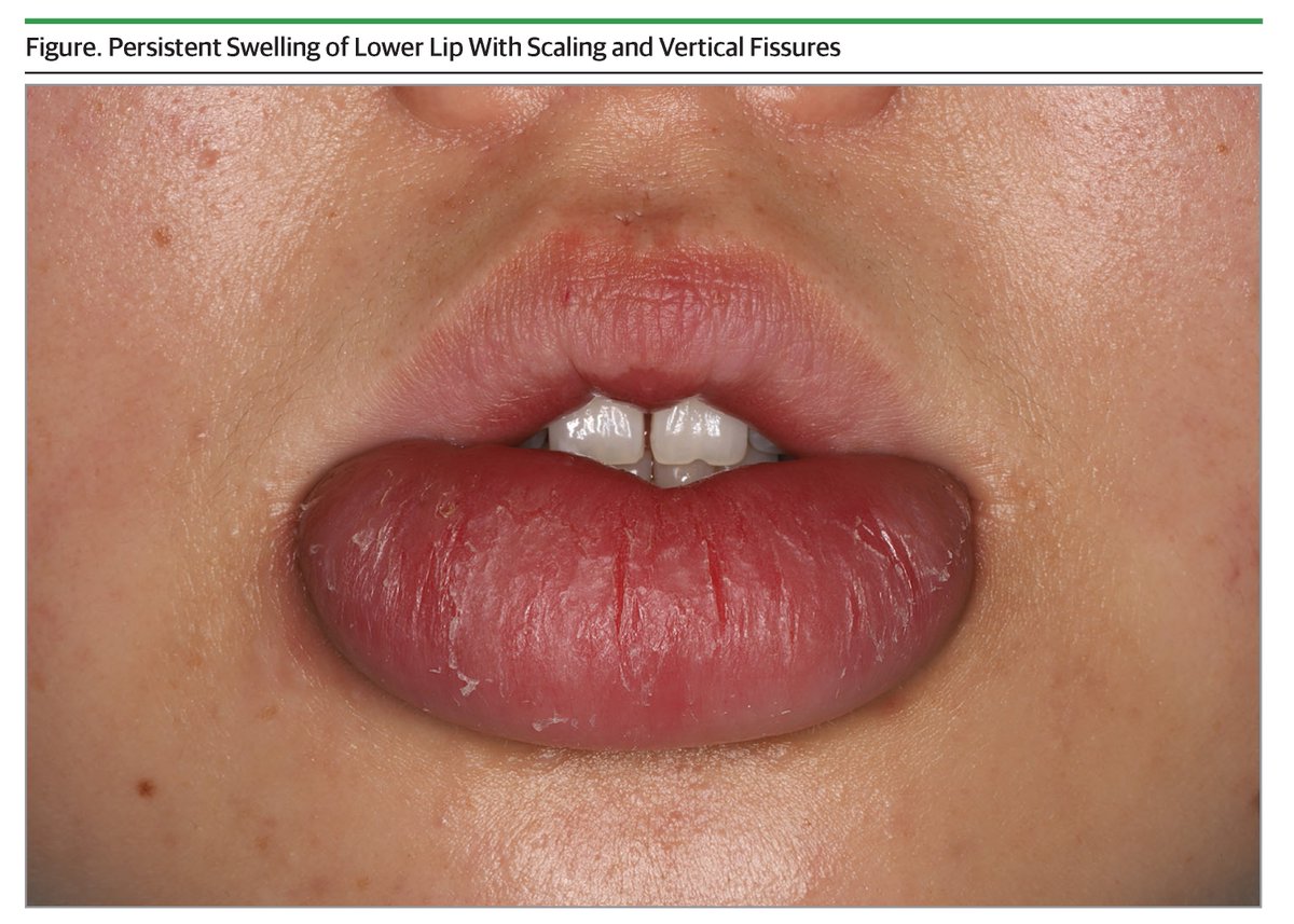 JAMA Dermatology tweet media