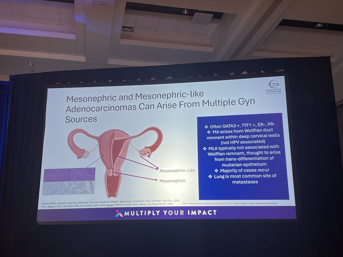 YingLiu88's tweet image. My amazing colleague #RachelGrisham bringing novel therapies to rare cancer types! Avutometinib + Defactinib shows promise in mesonephric tumors and is moving to 2nd stage. Great moderating by @ROCearbhaill #SGO2025. @TeamOvary_MSK @TeamEndo_MSK @MSK_DeptOfMed @MSKCancerCenter
