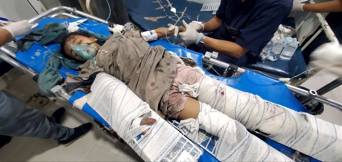 شهداء أشلاء هذه المرة ليس في غزة او لبنان او سوريا 

هذه المرة في اليمن 🇾🇪