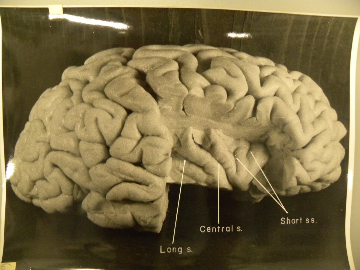 Harvey's original photos of his dissection of Einstein's brain had been lost >1/2 century. We found 14 and Dean Falk labeled each gyrus/sulcus on 14 photos &amp; when compared w/cortical atlases (Connolly's, Ono's), cortex of each lobe of AE's brain was a variant. Brain 2013 136:1304