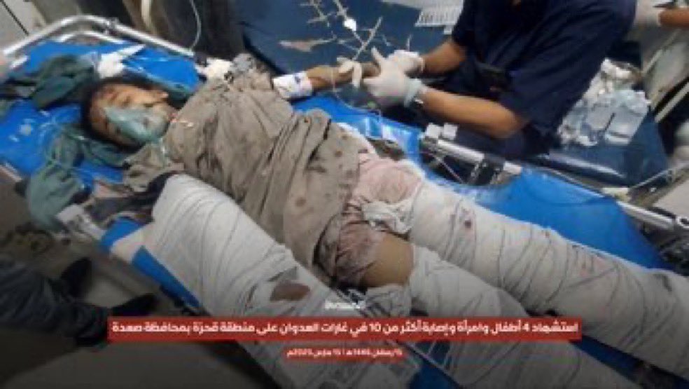 Partisangirl's tweet photo. Trump is killing Yemeni children because Miriam Adelson paid him 100 million dollars. https://t.co/eciy1hqouI