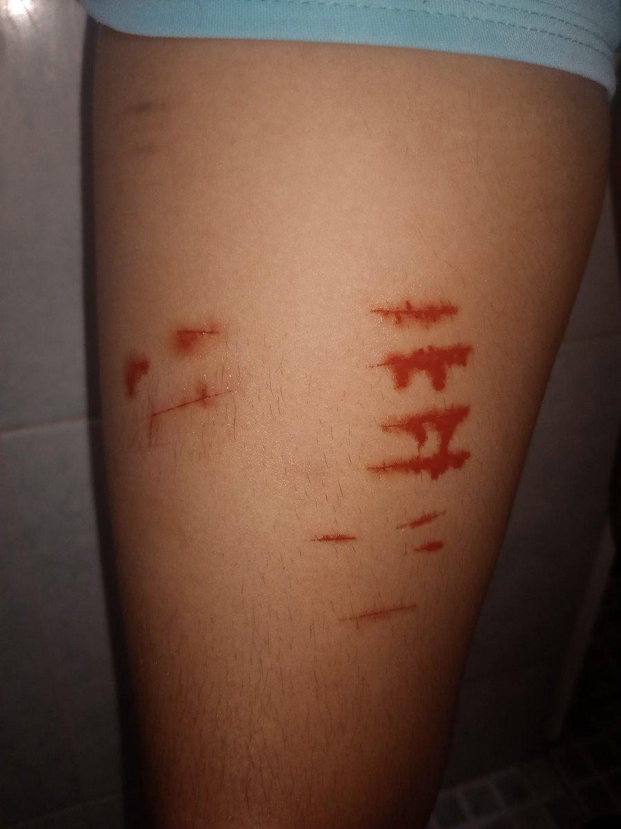 #selfharm #Blood #SH